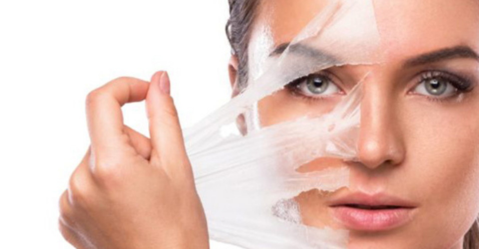 Chemical Peels for a Fresh Looking Skin