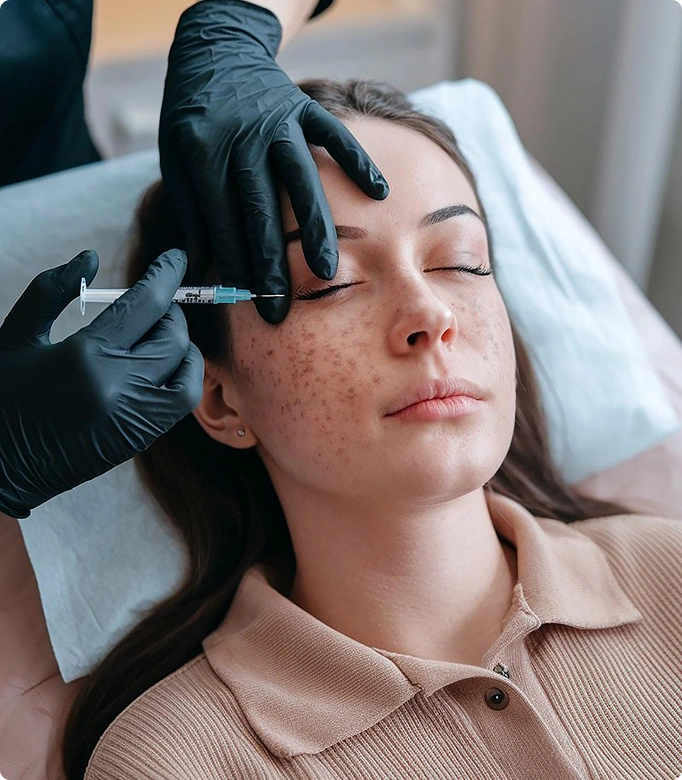 PRP injection being administered to a man's scalp for hair restoration.