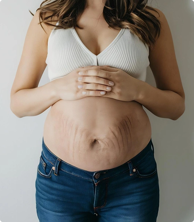 Mommy makeover procedure to address post-pregnancy changes with focus on abdominal area.
