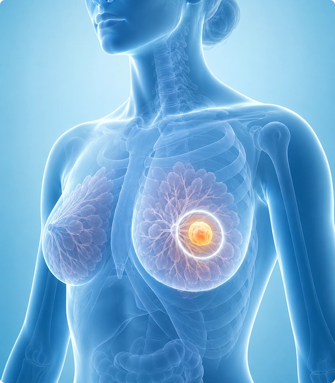3D illustration of minimal scar surgery for fibroadenoma, showcasing the removal of benign breast tissue with minimal scarring.