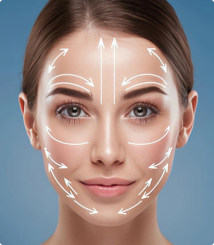 Thread lift procedure illustration showing lifting threads on a woman's face for facial rejuvenation.