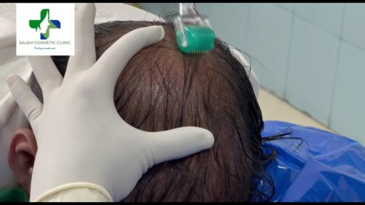 Video 1